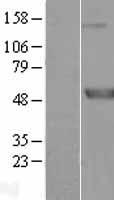 Meis homeobox 3 (MEIS3) Human Over-expression Lysate