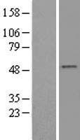 SMYD2 Human Over-expression Lysate