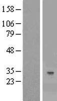 C7orf36 (YAE1D1) Human Over-expression Lysate