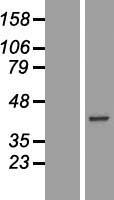 Carbonic anhydrase X (CA10) Human Over-expression Lysate