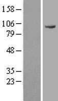 Cezanne (OTUD7B) Human Over-expression Lysate