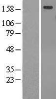 TULP4 Human Over-expression Lysate