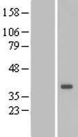 DTWD1 Human Over-expression Lysate