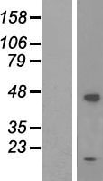 ADPRM Human Over-expression Lysate