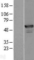 ANKMY2 Human Over-expression Lysate