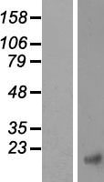CTNNBIP1 Human Over-expression Lysate