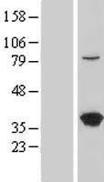 LZTFL1 Human Over-expression Lysate