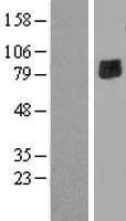 ENTPD7 Human Over-expression Lysate