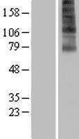 Fascin 3 (FSCN3) Human Over-expression Lysate