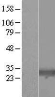 TIGAR Human Over-expression Lysate