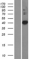 PDSS2 Human Over-expression Lysate