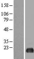 EIF5A2 Human Over-expression Lysate