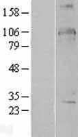 DDX24 Human Over-expression Lysate