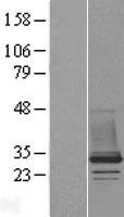 CHMP1B Human Over-expression Lysate