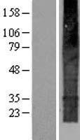 LDAF1 Human Over-expression Lysate