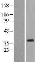 KIAA1191 Human Over-expression Lysate