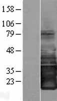 SMAGP Human Over-expression Lysate