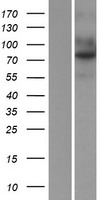 TEM1 (CD248) Human Over-expression Lysate