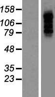 PBXIP1 Human Over-expression Lysate