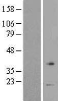 VN1R1 Human Over-expression Lysate