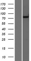 Choline Acetyltransferase (CHAT) Human Over-expression Lysate