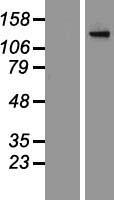 ADCY2 Human Over-expression Lysate