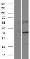 Nogo A (RTN4) Human Over-expression Lysate