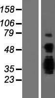 Achaete scute homolog 3 (ASCL3) Human Over-expression Lysate