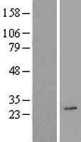 AICDA Human Over-expression Lysate