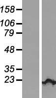 KIAA1143 Human Over-expression Lysate