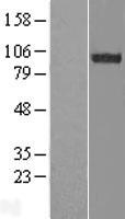 FAM62B (ESYT2) Human Over-expression Lysate