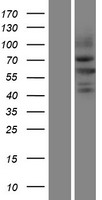 NEDL2 (HECW2) Human Over-expression Lysate