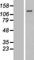 SENP7 Human Over-expression Lysate