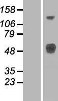 LRTM1 Human Over-expression Lysate
