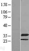 NMRAL1 Human Over-expression Lysate