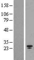 SPC25 Human Over-expression Lysate