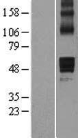 AADACL1 (NCEH1) Human Over-expression Lysate