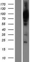 WDR48 Human Over-expression Lysate