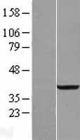 RDH14 Human Over-expression Lysate