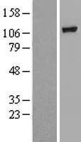 GBA2 Human Over-expression Lysate