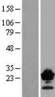 Claudin 9 (CLDN9) Human Over-expression Lysate