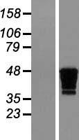 CKMT1B Human Over-expression Lysate
