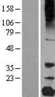 gamma C Crystallin (CRYGC) Human Over-expression Lysate