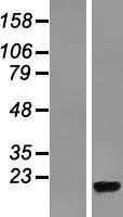 RPL36A Human Over-expression Lysate