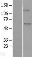 UGT (UGT1A9) Human Over-expression Lysate