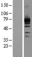 LZTS1 Human Over-expression Lysate