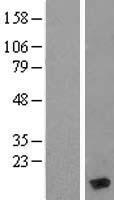 Myosin (MYL6) Human Over-expression Lysate