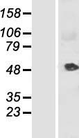 KRT34 Human Over-expression Lysate