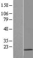 H3C14 Human Over-expression Lysate