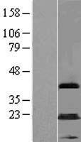 MAGEA5P Human Over-expression Lysate